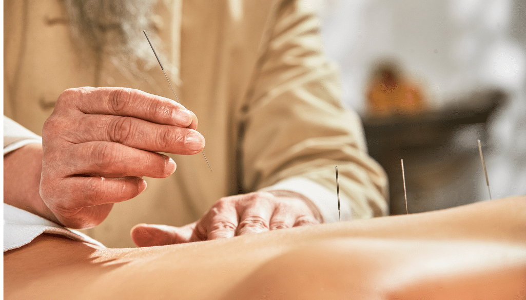 A serene and calming acupuncture session in a wellness center. A patient lies peacefully on a treatment table, their body adorned with delicate acupuncture needles. The room is bathed in warm, golden light, creating a soothing atmosphere. Surrounding the table are various traditional Chinese medicinal herbs, bowls, and tools used in acupuncture practice. The walls are adorned with calming, abstract artwork. A sense of harmony and balance permeates the scene, reflecting the holistic nature of acupuncture and its ability to promote overall wellness.